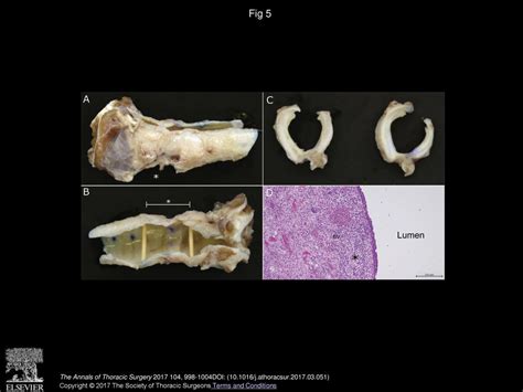 3d result 2021|Improved Composite Hydrogel for Bioengineered Tracheal Graft .